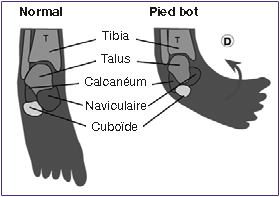 Pied-bot-anatomie